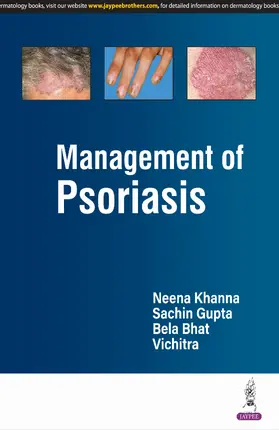 Khanna / Gupta / Bhat |  Management of Psoriasis | Buch |  Sack Fachmedien