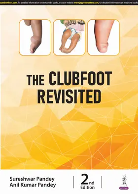 Pandey |  The Clubfoot Revisited | Buch |  Sack Fachmedien