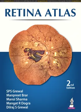 Grewal / Brar / Sharma |  Retina Atlas | Buch |  Sack Fachmedien