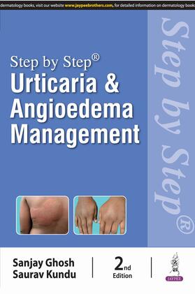 Ghosh / Kundu | Step by Step: Urticaria & Angioedema Management | Buch | 978-93-5696-982-7 | sack.de