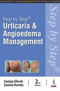 Ghosh / Kundu |  Step by Step: Urticaria & Angioedema Management | Buch |  Sack Fachmedien