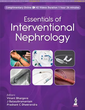 Bhargava / Balasubramaniam / Dheerendra |  Essentials of Interventional Nephrology | Buch |  Sack Fachmedien