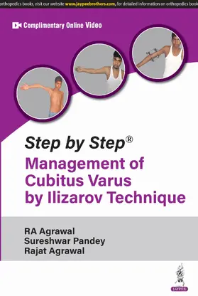 Agrawal / Pandey |  Step by Step: Management of Cubitus Varus by Ilizarov Technique | Buch |  Sack Fachmedien