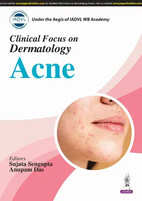 Sengupta / Das |  Clinical Focus on Dermatology: Acne | Buch |  Sack Fachmedien
