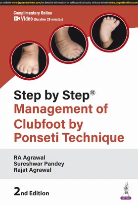 Agrawal / Pandey |  Step by Step: Management of Clubfoot by Ponseti Technique | Buch |  Sack Fachmedien