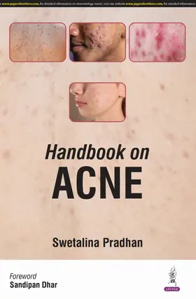 Pradhan / Shahid / Paul |  Handbook on Acne | Buch |  Sack Fachmedien