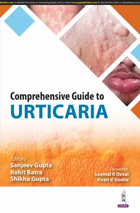 Batra / Gupta |  Comprehensive Guide to Urticaria | Buch |  Sack Fachmedien