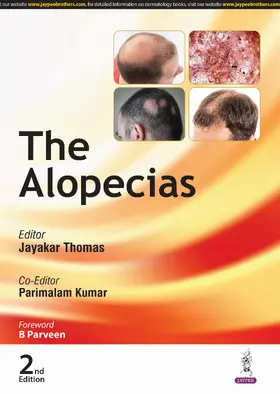 Thomas / Kumar |  The Alopecias | Buch |  Sack Fachmedien