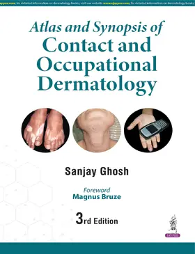 Ghosh |  Atlas and Synopsis of Contact and Occupational Dermatology | Buch |  Sack Fachmedien