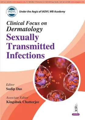 Das / Chatterjee |  Clinical Focus on Dermatology: Sexually Transmitted Infections | Buch |  Sack Fachmedien