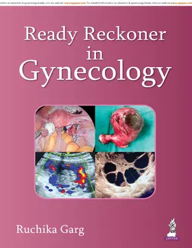 Garg |  Ready Reckoner in Gynecology | Buch |  Sack Fachmedien