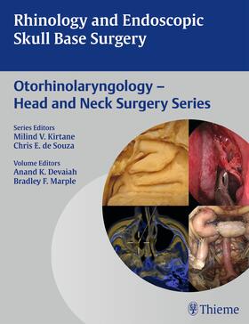 Devaiah / Marple |  Rhinology and Endoscopic Skull Base Surgery | eBook | Sack Fachmedien