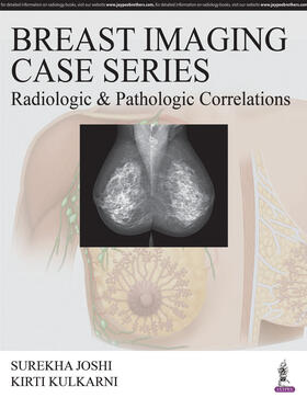 Joshi / Kulkarni | Breast Imaging Case Series: Radiologic & Pathologic Correlations | Buch | 978-93-85999-10-9 | sack.de