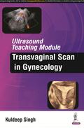 Singh |  Ultrasound Teaching Module: Transvaginal Scan in Gynecology | Buch |  Sack Fachmedien