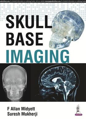 Midyett / Mukherji | Skull Base Imaging | Buch | 978-93-85999-31-4 | sack.de