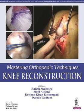Malhotra / Apsingi / Eachempati | Mastering Orthopedic Techniques: Knee Reconstruction | Buch | 978-93-85999-73-4 | sack.de