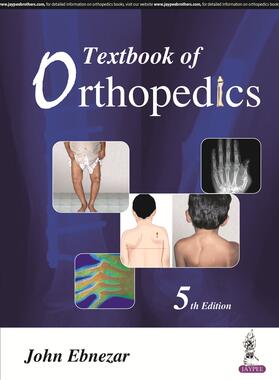 Ebnezar | Textbook of Orthopedics | Buch | 978-93-86056-68-9 | sack.de
