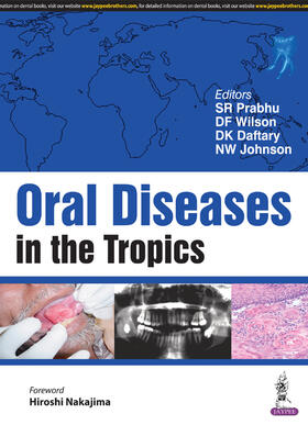 Prabhu / Wilson / Daftary | ORAL DISEASES IN THE TROPICS | Buch | 978-93-86150-55-4 | sack.de