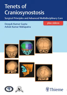 Gupta / Mahapatra | Tenets of Craniosynostosis | Buch | 978-93-86293-56-5 | sack.de