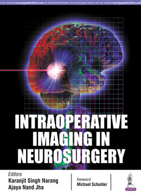 Narang / Jha | INTRAOPERATIVE IMAGING IN NEUROSURGERY | Buch | 978-93-86322-90-6 | sack.de