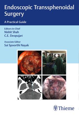 Shah / Deopujari |  Endoscopic Transsphenoidal Surgery | Buch |  Sack Fachmedien