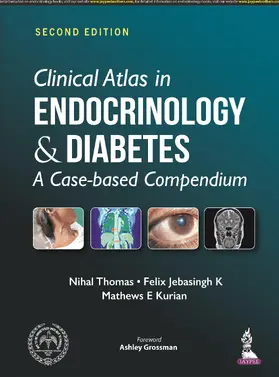 Thomas / Jebasingh K / Kurian | Clinical Atlas in Endocrinology and Diabetes | Buch | 978-93-89587-30-2 | sack.de