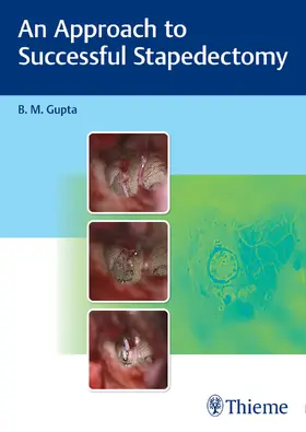 Gupta |  An Approach to Successful Stapedectomy | Buch |  Sack Fachmedien