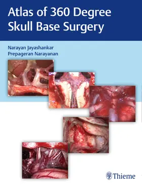 Jayashankar / Narayanan |  Atlas of 360 Degree Skull Base Surgery | Buch |  Sack Fachmedien