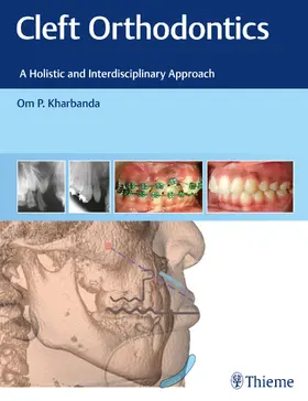 Kharbanda | Cleft Orthodontics | E-Book | sack.de