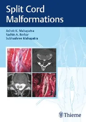 Mahapatra / Borkar | Split Cord Malformations | E-Book | sack.de