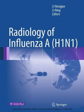 Li |  Radiology of Influenza A (H1N1) | eBook | Sack Fachmedien