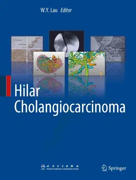 Lau | Hilar Cholangiocarcinoma | E-Book | www.sack.de