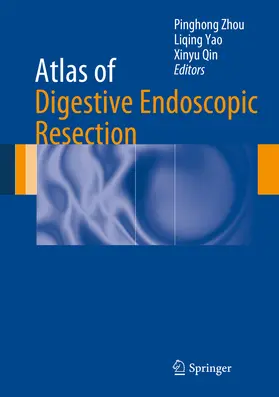 Zhou / Yao / Qin |  Atlas of Digestive Endoscopic Resection | eBook | Sack Fachmedien