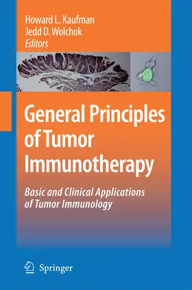Kaufman / Wolchok |  General Principles of Tumor Immunotherapy | Buch |  Sack Fachmedien