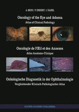 Brini / Dhermy / Sahel |  Oncology of the Eye and Adnexa / Oncologie de l’Œil et des Annexes / Onkologische Diagnostik in der Ophthalmologie | eBook | Sack Fachmedien