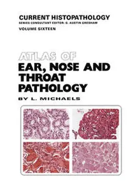 Michaels |  Atlas of Ear, Nose and Throat Pathology | eBook | Sack Fachmedien