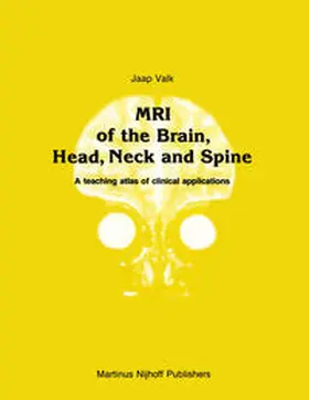 Valk |  MRI of the Brain, Head, Neck and Spine | eBook | Sack Fachmedien