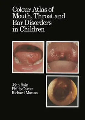 Bain / Morton / Carter |  Colour Atlas of Mouth, Throat and Ear Disorders in Children | eBook | Sack Fachmedien