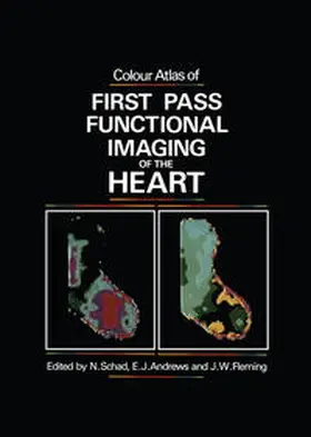 Schad |  Colour Atlas of First Pass Functional Imaging of the Heart | eBook | Sack Fachmedien