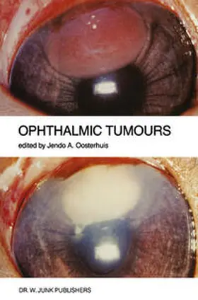 Oosterhuis |  Ophthalmic Tumours | eBook | Sack Fachmedien