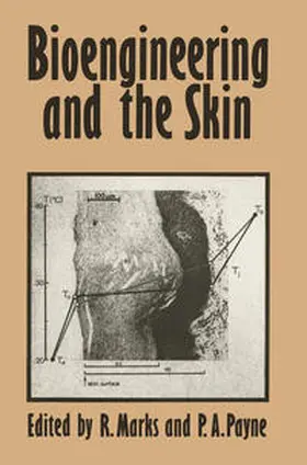 Marks |  Bioengineering and the Skin | eBook | Sack Fachmedien