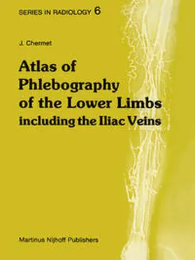 Chermet |  Atlas of Phlebography of the Lower Limbs | eBook | Sack Fachmedien