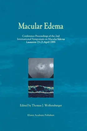 Wolfensberger |  Macular Edema | Buch |  Sack Fachmedien