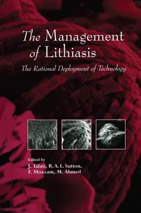 Talati / Sutton / Moazam |  The Management of Lithiasis | Buch |  Sack Fachmedien