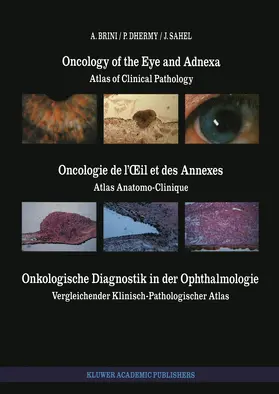 Brini / Dhermy / Sahel |  Oncology of the Eye and Adnexa / Oncologie de l'¿il et des Annexes / Onkologische Diagnostik in der Ophthalmologie | Buch |  Sack Fachmedien