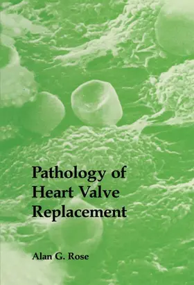 Rose |  Pathology of Heart Valve Replacement | Buch |  Sack Fachmedien