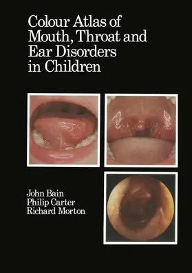Bain / Morton / Carter |  Colour Atlas of Mouth, Throat and Ear Disorders in Children | Buch |  Sack Fachmedien