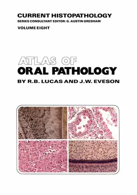 Eveson / Lucas |  Atlas of Oral Pathology | Buch |  Sack Fachmedien