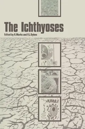 Marks / Dykes |  The Ichthyoses | Buch |  Sack Fachmedien