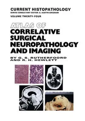 Rutherfoord / Hewlett | Atlas of Correlative Surgical Neuropathology and Imaging | E-Book | sack.de